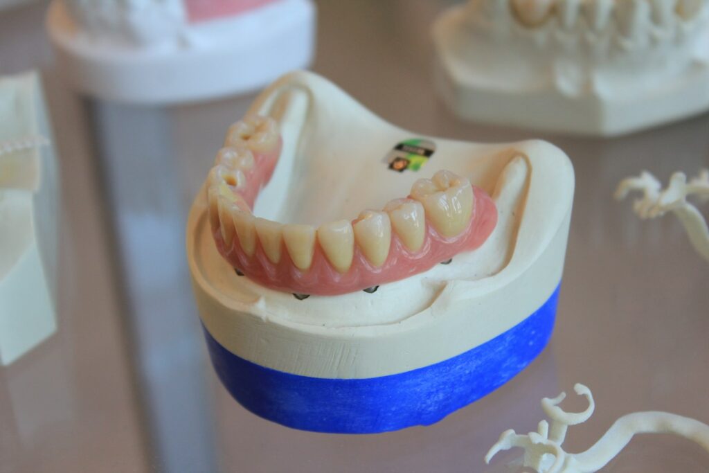 Full denture on a dental laboratory model